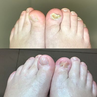 Pieredze, izmantojot Izraēlu, pirms un pēc