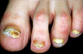 Slimības raksturojums